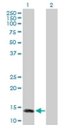 Western Blot: MTTP Antibody [H00004547-B01P] - Analysis of MTTP expression in transfected 293T cell line by MTTP polyclonal antibody.  Lane 1: MTTP transfected lysate(16.61 KDa). Lane 2: Non-transfected lysate.