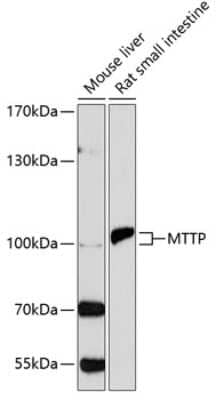 Western Blot: MTTP Antibody [NBP2-94915] - Analysis of extracts of various cell lines, using MTTP at 1:1000 dilution.Secondary antibody: HRP Goat Anti-Rabbit IgG (H+L) at 1:10000 dilution.Lysates/proteins: 25ug per lane.Blocking buffer: 3% nonfat dry milk in TBST.Detection: ECL Basic Kit .Exposure time: 90s.