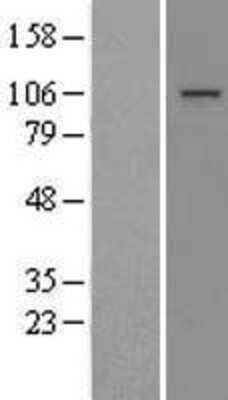 Western Blot: MTTP Overexpression Lysate (Adult Normal) [NBL1-13387] Left-Empty vector transfected control cell lysate (HEK293 cell lysate); Right -Over-expression Lysate for MTTP.