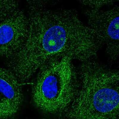 Immunocytochemistry/Immunofluorescence: MTUS1 Antibody [NBP2-57208] - Staining of human cell line A549 shows localization to nucleoli & microtubules.