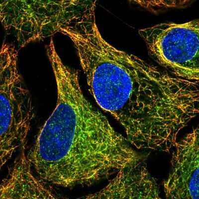 Immunocytochemistry/Immunofluorescence: MTUS1 Antibody [NBP2-57447] - Staining of human cell line A549 shows localization to microtubules.