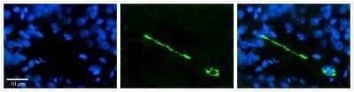 Immunohistochemistry: MTUS1 Antibody [NBP1-60099] - Formalin Fixed Paraffin Embedded Tissue: Human Pineal Tissue Observed Staining: Cytoplasmic and membrane in cell bodies of pinealocytes and their processes Primary Antibody Concentration: 1:100 Other Working Concentrations: 1/600 Secondary Antibody: Donkey anti-Rabbit-Cy3 Secondary Antibody Concentration: 1:200 Magnification: 20X Exposure Time: 0.5 - 2.0 sec