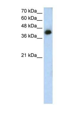 Western Blot MTUS1 Antibody - BSA Free