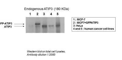 Western Blot: MTUS1 Antibody [NBP1-60099] - MTUS1 antibody - middle region validated by WB using MCF-7, HeLa, and human cancer cell lines at 1:2000.