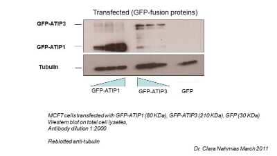 Western Blot: MTUS1 Antibody [NBP1-60099] - MTUS1 antibody - middle region validated by WB using MCF-7, HeLa, and human cancer cell lines at 1:2000.