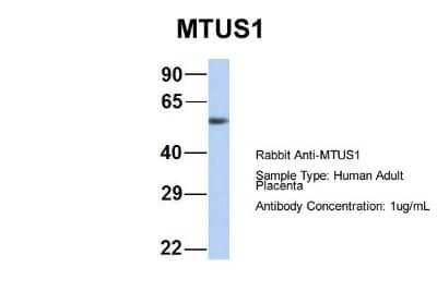 Western Blot: MTUS1 Antibody [NBP1-60099] - Sample Type: Human Adult Placenta Antibody Dilution: 1.0 ug/ml