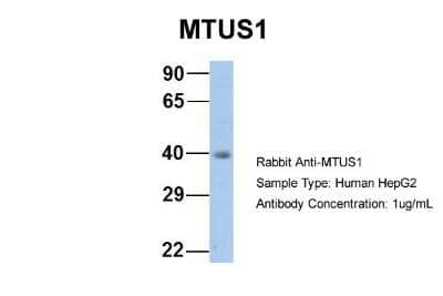 Western Blot: MTUS1 Antibody [NBP1-60099] - Sample Type: HepG2 Antibody Dilution: 1.0 ug/ml. MTUS1 is strongly supported by BioGPS gene expression data to be expressed in HepG2