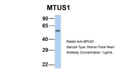 Western Blot: MTUS1 Antibody [NBP1-60099] - Sample Type: Human Fetal Heart Antibody Dilution: 1.0 ug/ml