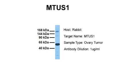 Western Blot: MTUS1 Antibody [NBP1-60099] - Sample Tissue: Human Ovary Tumor Antibody Dilution: 1.0 ug/ml