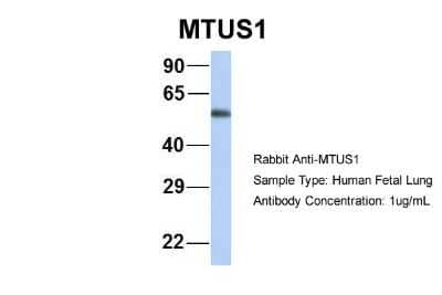 Western Blot MTUS1 Antibody - BSA Free
