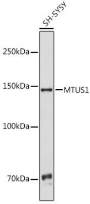 Western Blot: MTUS1 Antibody [NBP3-15462] - Western blot analysis of extracts of SH-SY5Y cells, using MTUS1 antibody (NBP3-15462) at 1:1000 dilution. Secondary antibody: HRP Goat Anti-Rabbit IgG (H+L) at 1:10000 dilution. Lysates/proteins: 25ug per lane. Blocking buffer: 3% nonfat dry milk in TBST. Detection: ECL Basic Kit. Exposure time: 3s.