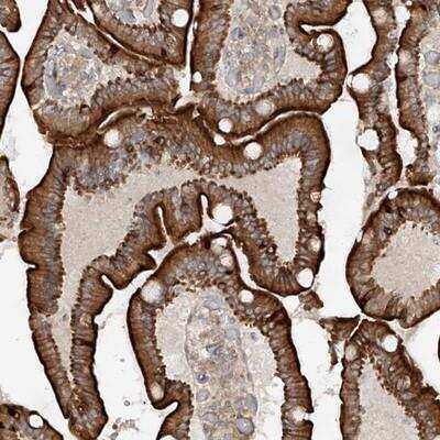 Immunohistochemistry: MTUS2 Antibody [NBP1-86605] - Staining of human duodenum shows strong cytoplasmic positivity in glandular cells.