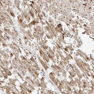 Immunohistochemistry-Paraffin: MTUS2 Antibody [NBP2-54923] - Immunohistochemical staining of human heart muscle shows moderate cytoplasmic positivity in myocytes.