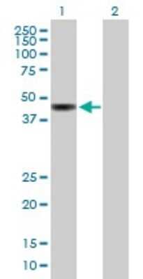 Western Blot: MTUS2 Antibody [H00023281-B01P] - Analysis of KIAA0774 expression in transfected 293T cell line by KIAA0774 polyclonal antibody.  Lane 1: KIAA0774 transfected lysate(38.28 KDa). Lane 2: Non-transfected lysate.