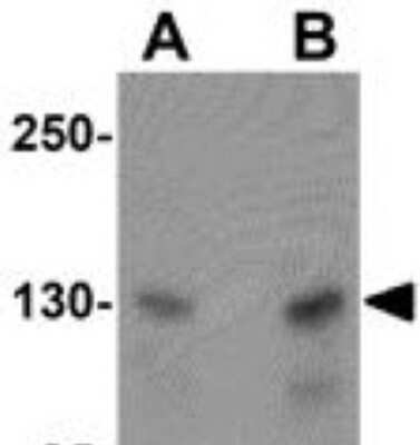 Western Blot: MTUS2 Antibody [NBP1-77130] - A20 cell lysate with CAZIP antibody at (A) 0.5 and (B) 1 ug/ml.