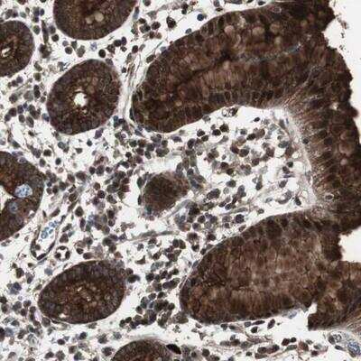 Immunohistochemistry-Paraffin: MUC-1 Antibody [NBP1-85780] - Staining of human stomach shows strong cytoplasmic and nuclear positivity in glandular cells.