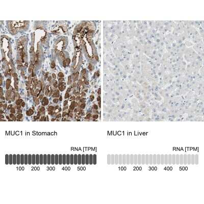 Immunohistochemistry-Paraffin: MUC1 Antibody [NBP1-85778] - Staining in human stomach and liver tissues using anti-MUC1 antibody. Corresponding MUC1 RNA-seq data are presented for the same tissues.