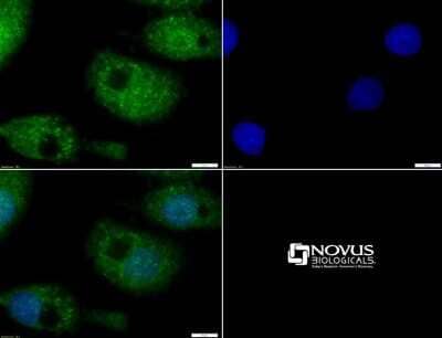 Immunocytochemistry/Immunofluorescence: MUC4 Antibody [NBP1-52193] - Staining of MUC4 in HepG2 cells with FITC (green). Nuclei were counterstained with DAPI (blue).