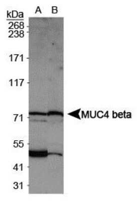 Western Blot: MUC4 Antibody [NBP1-52193] - Analysis of MUC4 beta in MCF7 whole cell extract (A) and HeLa whole cell extract (B).