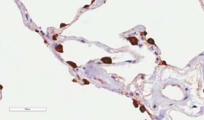 Immunohistochemistry-Paraffin: MUC1 Antibody (HMFG2) - Chimeric [NBP2-62565] - Immunohistochemical staining of human lung tissue using anti-MUC1 antibody. HMFG2 Anti-MUC1 (Mucin-1) staining of paraffin embedded human lung tissue using the rabbit-chimeric version of HMFG2 (NBP2-62565). Antigen retreival was acheived by microwaving in citrate buffer (pH6), followed by blocking with protein block serum-free buffer. Primary antibody incubation with NBP2-62565 was carried out at 4 ug/ml for 30 minutes. Samples were then incubated with an anti-rabbit IgG HRP secondary antibody for 20 mins followed by DAB (3,3'-diaminobenzidine), and counter-staining with haemotoxylin. Strong staining of type II pneumocytes may be observed. Recommended concentration, 1-2 ug/ml.