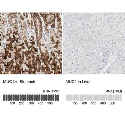 Immunohistochemistry-Paraffin: MUC1 Antibody [NBP1-85779] - Analysis in human stomach and liver tissues. Corresponding MUC1 RNA-seq data are presented for the same tissues.