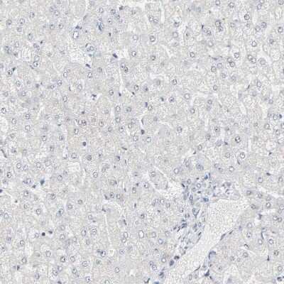 Immunohistochemistry-Paraffin: MUC1 Antibody [NBP1-85779] - Staining of human liver shows no positivity in hepatocytes as expected.