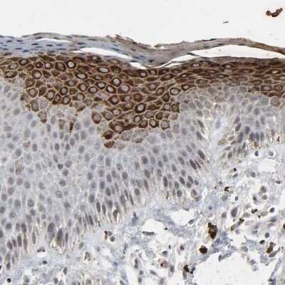 Immunohistochemistry-Paraffin: MUC1 Antibody [NBP1-85779] - Staining of human skin shows strong cytoplasmic positivity in squamous epithelial cells.