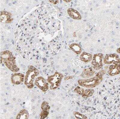 <b>Orthogonal Strategies Validation. </b>Immunohistochemistry-Paraffin: MUC1 Antibody [NBP1-85779] -  Staining of human kidney shows moderate cytoplasmic positivity in cells in distal tubules.