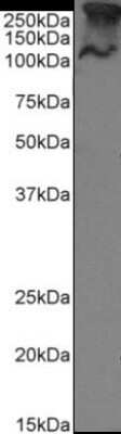 Western Blot: MUC1 Antibody (SM3) - Chimeric [NBP2-62561] - Western Blot using anti-MUC1 antibody SM3. MCF-7 cell lysate (35ug protein in RIPA buffer) were resolved on a 10% SDS PAGE gel and blots probed with the chimeric rabbit version of SM3 (NBP2-62561) at 1 ug/ml before detection using an anti-rabbit secondary antibody. A primary incubation of 1h was used and protein was detected by chemiluminescence. The predicted band size for unmodified MUC1 is 122.1kDa, though in breast cancer cell lines like MCF-7 MUC1 can be up to 90% glycosylated (c.f. Mueller et al. PMID: 10373415; T47D cells) and expected band sizes are ~250-300kDa. Thus the two bands likely represent processed (>250kDa) and unprocessed (~121kDa) populations of the protein. NBP2-62561 successfully detected human MUC1 in MCF-7 breast cancer cells.