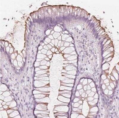 Immunohistochemistry-Paraffin: MUC12 Antibody [NBP1-82607] - Staining of human rectum shows moderate positivity in luminal membrane of glandular cells.