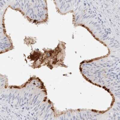 Immunohistochemistry-Paraffin MUC15 Antibody