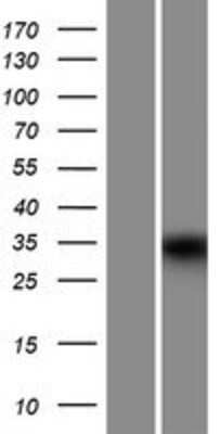 Western Blot: MUC15 Overexpression Lysate (Adult Normal) [NBP2-09564] Left-Empty vector transfected control cell lysate (HEK293 cell lysate); Right -Over-expression Lysate for MUC15.