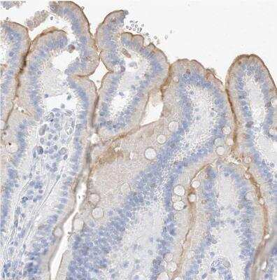 Immunohistochemistry-Paraffin: MUC17 Antibody [NBP1-91013] -  Staining of human duodenum shows moderate membranous positivity in glandular cells.