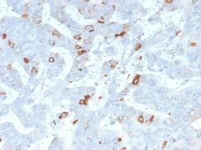 Immunohistochemistry-Paraffin: MUC2 Antibody (MLP/2970R) - Azide and BSA Free [NBP3-08240] - Formalin-fixed, paraffin-embedded human colon stained with MUC2 Rabbit Recombinant Monoclonal Antibody (MLP/2970R).