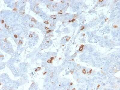 Immunohistochemistry-Paraffin: MUC2 Antibody (MLP/2970R) [NBP3-07238] - Formalin-fixed, paraffin-embedded human colon stained with MUC2 Rabbit Recombinant Monoclonal Antibody (MLP/2970R).