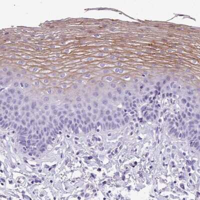<b>Orthogonal Strategies Validation. </b>Immunohistochemistry-Paraffin: MUC21 Antibody [NBP2-31023] - Staining of human esophagus shows moderate membranous positivity in squamous epithelial cells.