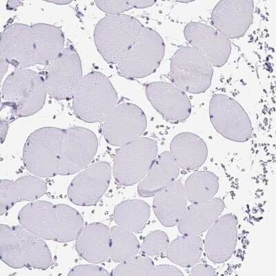 Immunohistochemistry-Paraffin: MUC21 Antibody [NBP2-31023] - Staining of human skeletal muscle shows no positivity in myocytes.