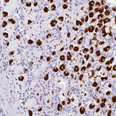 Immunohistochemistry-Paraffin: MUC21 Antibody [NBP2-31023] - Staining of human stomach shows strong cytoplasmic positivity in parietal cells.
