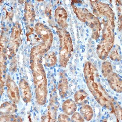 Immunohistochemistry-Paraffin: MUC4 Antibody (5J3R7) [NBP3-16186] - Immunohistochemistry of paraffin-embedded rat kidney using MUC4 Rabbit mAb (NBP3-16186) at dilution of 1:100 (40x lens).Perform microwave antigen retrieval with 10 mM Tris/EDTA buffer pH 9.0 before commencing with IHC staining protocol.