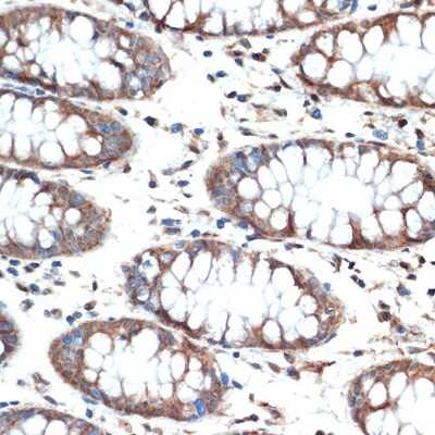 Immunohistochemistry-Paraffin: MUC4 Antibody (5J3R7) [NBP3-16186] - Immunohistochemistry of paraffin-embedded human colon using MUC4 Rabbit mAb (NBP3-16186) at dilution of 1:100 (40x lens).Perform microwave antigen retrieval with 10 mM Tris/EDTA buffer pH 9.0 before commencing with IHC staining protocol.