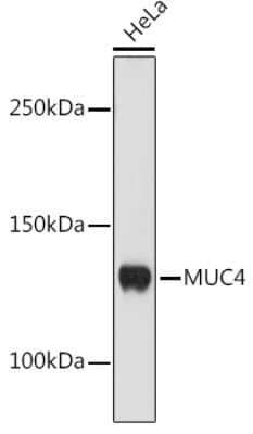 Western Blot: MUC4 Antibody (5J3R7) [NBP3-16186] - Western blot analysis of extracts of HeLa cells, using MUC4 antibody (NBP3-16186) at 1:1000 dilution. Secondary antibody: HRP Goat Anti-Rabbit IgG (H+L) at 1:10000 dilution. Lysates/proteins: 25ug per lane. Blocking buffer: 3% nonfat dry milk in TBST. Detection: ECL Enhanced Kit. Exposure time: 10s.