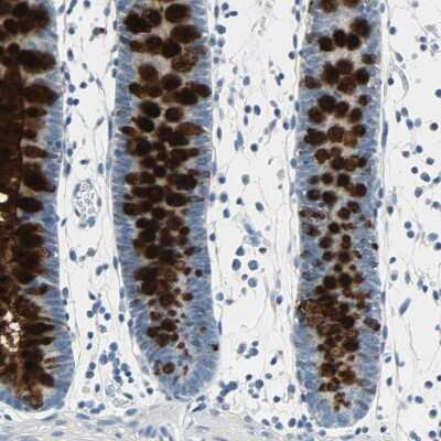 Immunohistochemistry-Paraffin: MUC4 Antibody [NBP1-86505] - Staining of human colon shows strong cytoplasmic positivity in glandular cells.