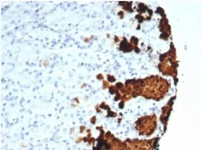 Immunohistochemistry-Paraffin: MUC5AC Antibody (MUC5AC/7067R) [NBP3-13975] - Formalin-fixed, paraffin-embedded human stomach stained with MUC5AC antibody (MUC5AC/7067R)at 2ug/ml. HIER: Tris/EDTA, pH9.0, 45min. HRP-polymer, 30min. DAB, 5min.
