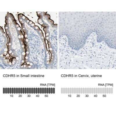 Immunohistochemistry-Paraffin: MUCDHL Antibody [NBP1-92148] - Staining in human small intestine and cervix, uterine tissues using anti-CDHR5 antibody. Corresponding CDHR5 RNA-seq data are presented for the same tissues.