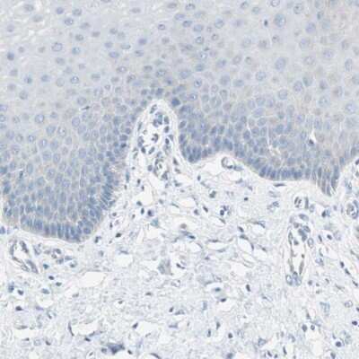 Immunohistochemistry-Paraffin: MUCDHL Antibody [NBP1-92149] - Staining of human cervix, uterine shows low expression as expected.