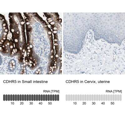 Immunohistochemistry-Paraffin: MUCDHL Antibody [NBP1-92149] - Staining in human small intestine and cervix, uterine tissues using anti-CDHR5 antibody. Corresponding CDHR5 RNA-seq data are presented for the same tissues.