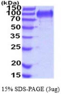 SDS-Page: MUCDHL Recombinant Protein [NBP2-52285] - 15% SDS Page (3 ug)