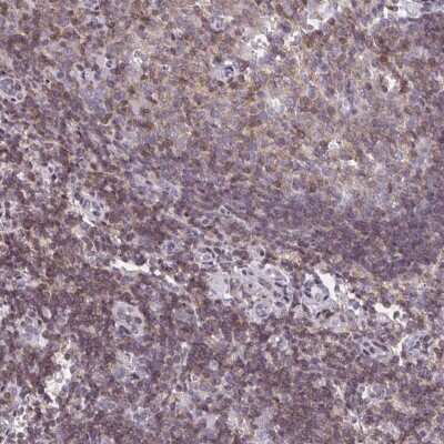 Immunohistochemistry MUDENG Antibody - BSA Free