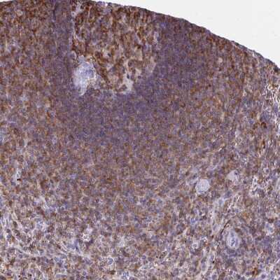 Immunohistochemistry-Paraffin: MUDENG Antibody [NBP2-33765] - Staining of human spleen shows strong cytoplasmic positivity in cells in white pulp.