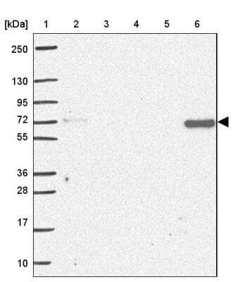 Western Blot: MUDENG Antibody [NBP2-33765] - Lane 1: Marker  [kDa] 250, 130, 95, 72, 55, 36, 28, 17, 10.  Lane 2: Human cell line RT-4.  Lane 3: Human cell line U-251MG sp.  Lane 4: Human plasma (IgG/HSA depleted).  Lane 5: Human liver tissue.  Lane 6: Human tonsil tissue